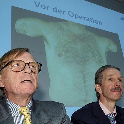 Хирургът проф. Едгар Биймър (вляво) разказва за уникалната операция