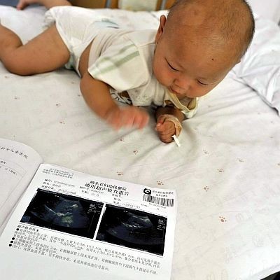 Китайско бебе, пило от опасното мляко с меламин