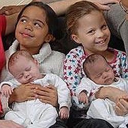 Близначки от различна раса се родиха в Англия
