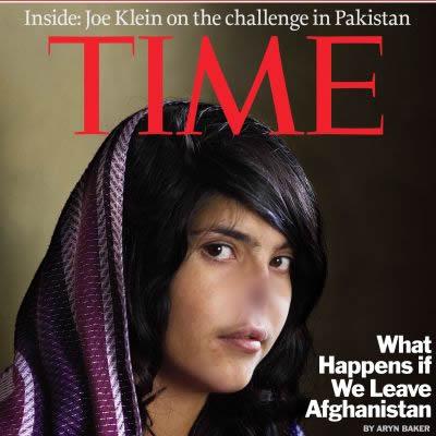 18-годишна девойка е била наказана от талибаните и съпруга си насилник, от когото избягала, с изрязване на ушите и носа