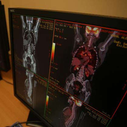 Апаратурата позволява ранна диагностика на ракови заболявания