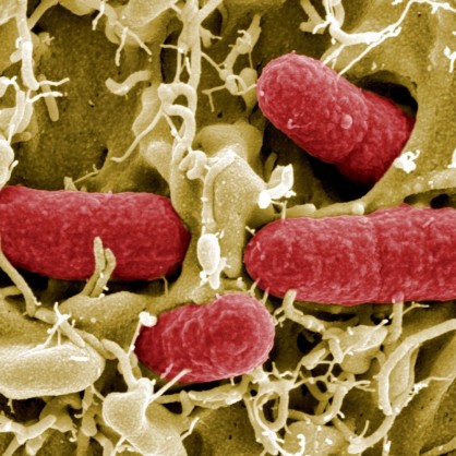 В Германия са силно притеснени от вестта за пагубната бактерия