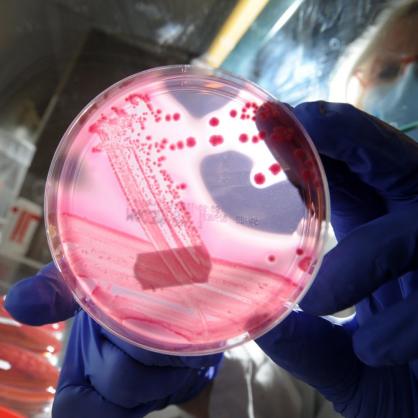 Бактерията ешерихия коли живее в храносмилателната система на хората