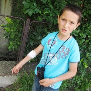 Ухапаното от змия дете в училището в Ловеч