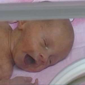34-годишната Антоанета Карагюрова, парализирана след катастрофа, стана майка на близнаци във Велико Търново
